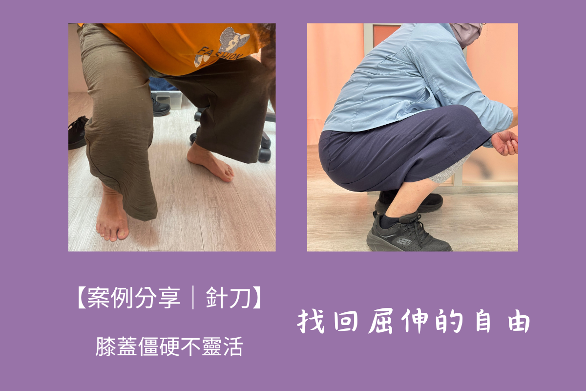 【雲玖醫案-針刀-花了數萬做膝蓋手術，卻還是蹲不下去01-高雄】